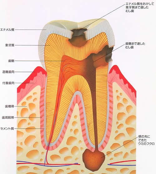 歯の構造