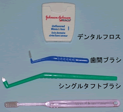 プラークコントロール（歯みがき）1